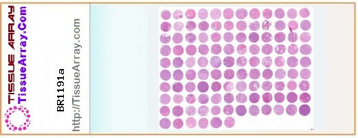 TissueArray.Com Tissue Array BR1191a
