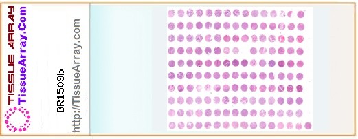 TissueArray.Com Tissue Array BR1509b
