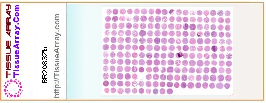 TissueArray.Com Tissue Array BR20837b