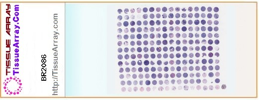 TissueArray.Com Tissue Array BR2086