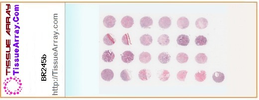 TissueArray.Com Tissue Array BR245b