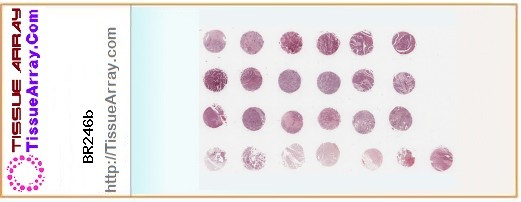 TissueArray.Com Tissue Array BR246b