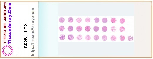 TissueArray.Com Tissue Array BR251-L62