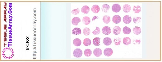 TissueArray.Com Tissue Array BR302