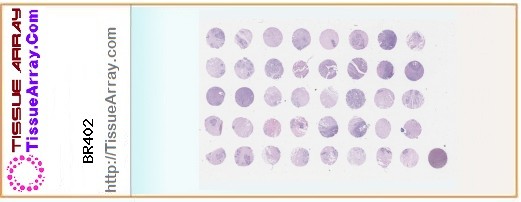 TissueArray.Com Tissue Array BR402