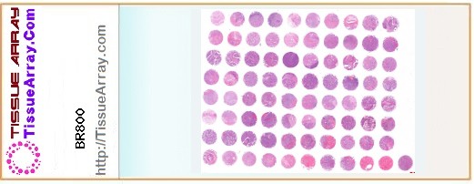 TissueArray.Com Tissue Array BR800