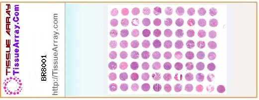 TissueArray.Com Tissue Array BR8001