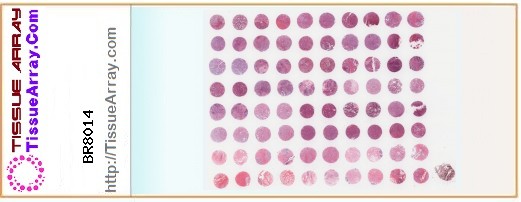 TissueArray.Com Tissue Array BR8014