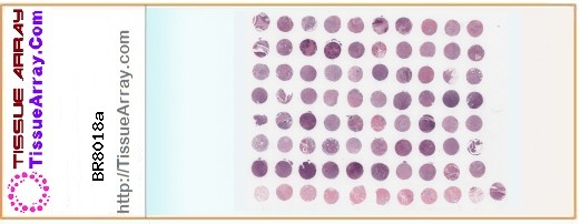 TissueArray.Com Tissue Array BR8018a