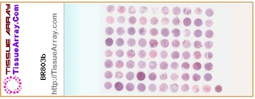 TissueArray.Com Tissue Array BR803b