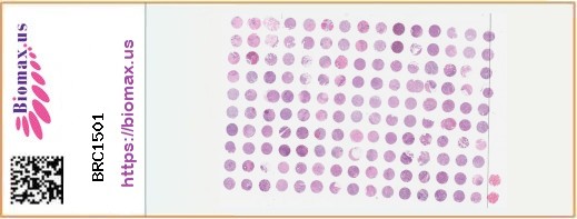 TissueArray.Com Tissue Array BRC1501