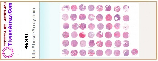 TissueArray.Com Tissue Array BRC491