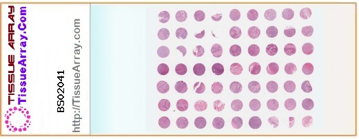 TissueArray.Com Tissue Array BS02041