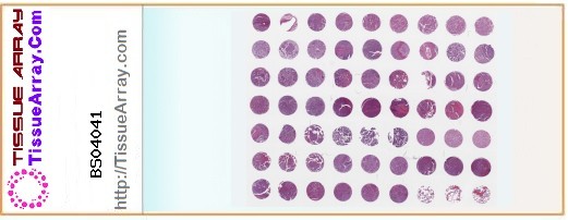 TissueArray.Com Tissue Array BS04041