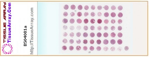 TissueArray.Com Tissue Array BS04081a