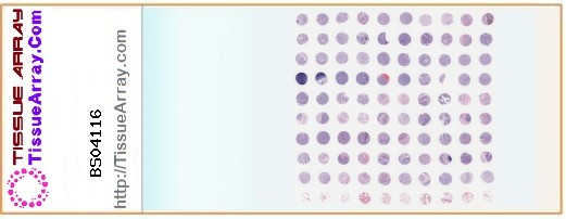 TissueArray.Com Tissue Array BS04116
