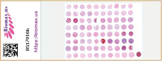 TissueArray.Com Tissue Array BS17016b