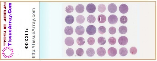 TissueArray.Com Tissue Array BS20011c