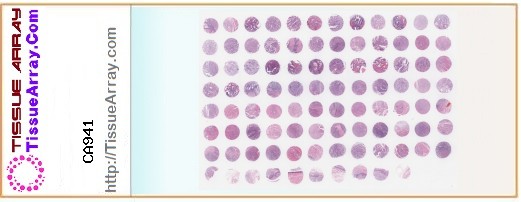 TissueArray.Com Tissue Array CA941
