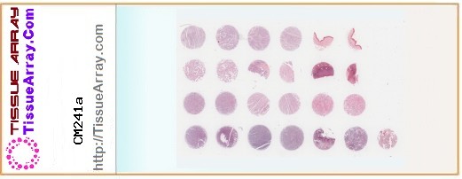TissueArray.Com Tissue Array CM241a