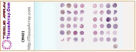 TissueArray.Com Tissue Array CM481