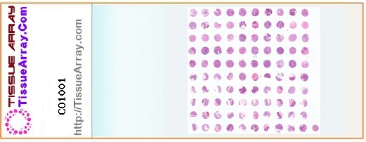 TissueArray.Com Tissue Array CO1001