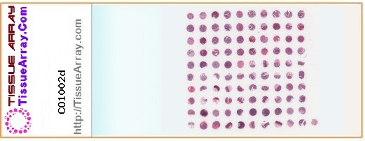 TissueArray.Com Tissue Array CO1002d