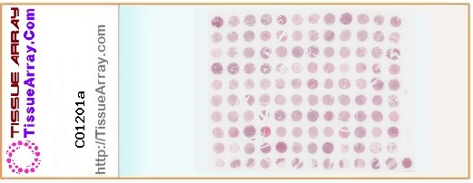 TissueArray.Com Tissue Array CO1201a