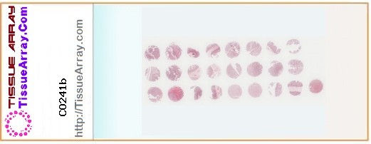 TissueArray.Com Tissue Array CO241b