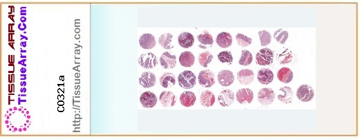 TissueArray.Com Tissue Array CO321a