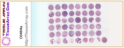 TissueArray.Com Tissue Array CO484a