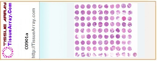 TissueArray.Com Tissue Array CO901a