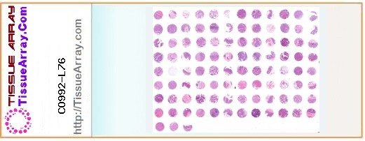 TissueArray.Com Tissue Array CO992-L76