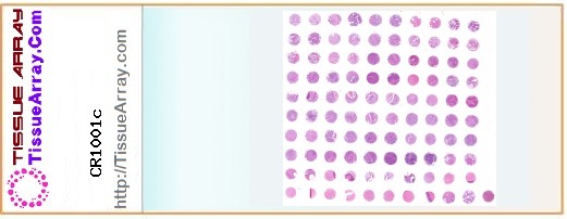 TissueArray.Com Tissue Array CR1001c