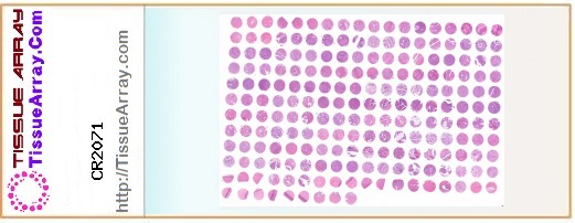 TissueArray.Com Tissue Array CR2071