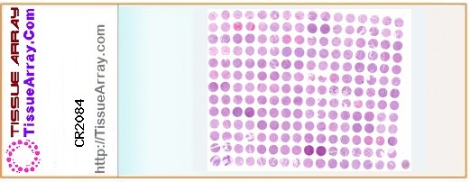 TissueArray.Com Tissue Array CR2084