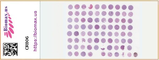 TissueArray.Com Tissue Array CR806