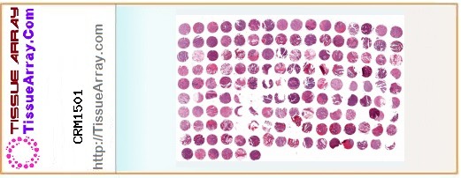 TissueArray.Com Tissue Array CRM1501