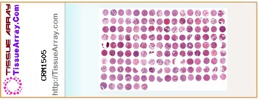 TissueArray.Com Tissue Array CRM1505