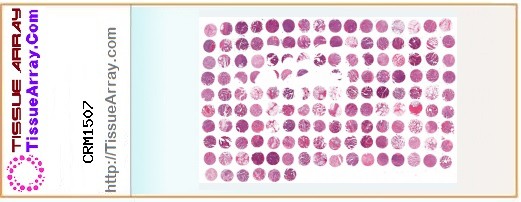 TissueArray.Com Tissue Array CRM1507