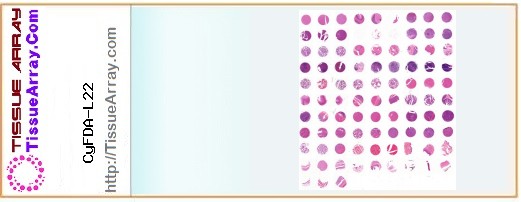 TissueArray.Com Tissue Array CyFDA-L22