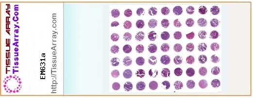 TissueArray.Com Tissue Array EM631a