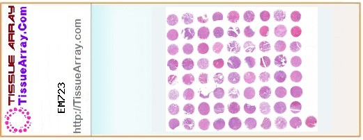 TissueArray.Com Tissue Array EM723
