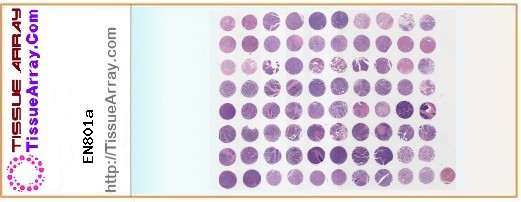 TissueArray.Com Tissue Array EN801a