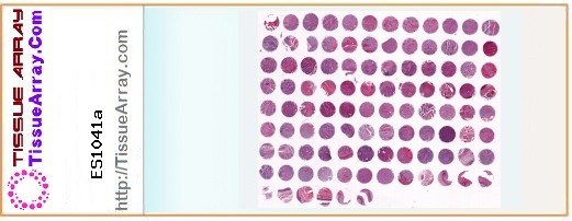 TissueArray.Com Tissue Array ES1041a