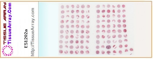 TissueArray.Com Tissue Array ES1202a