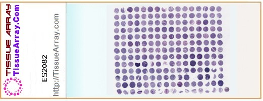TissueArray.Com Tissue Array ES2082