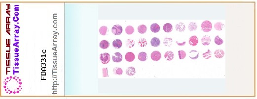 TissueArray.Com Tissue Array FDA331c