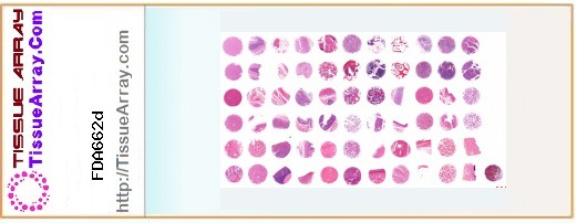 TissueArray.Com Tissue Array FDA662d