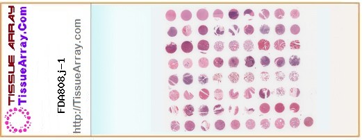TissueArray.Com Tissue Array FDA808j-1
